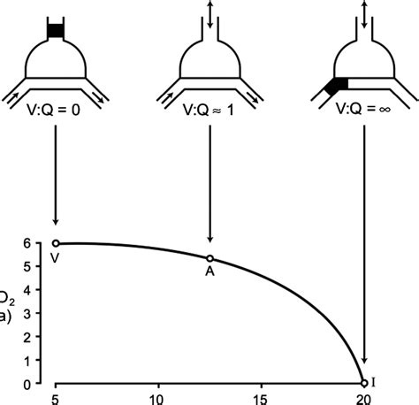 v/q ratio mismatch|v q mismatch diagram.